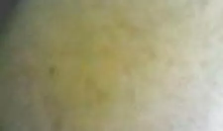 O médico examinou videos pornos nacionais caseiros a garota gordinha